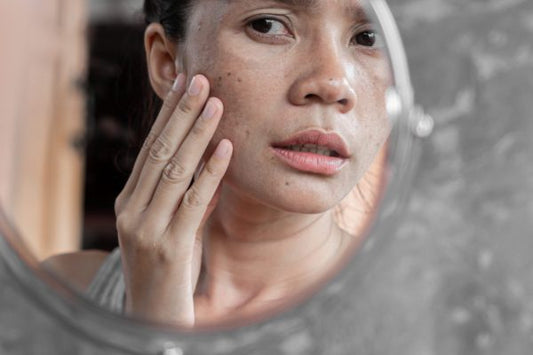 Woman examining dull skin in a mirror, illustrating common causes of dull and uneven-looking skin