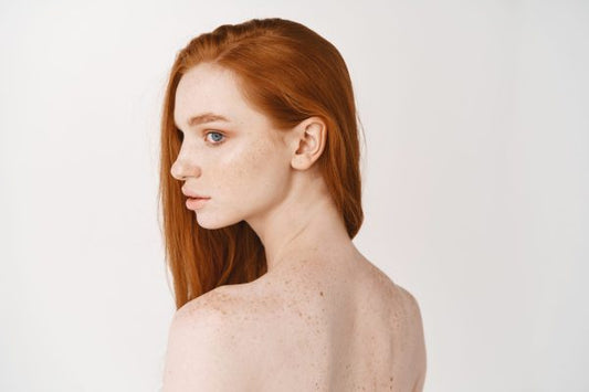Woman with fair freckled skin in profile, illustrating common causes of pale skin and treatment options